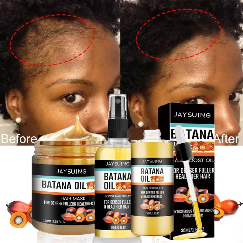 Fast Hair Growth Set Batana Oil Traction Alopecia Hair Mask anti Break Loss Hair Growth Oil Baldness Treatment Hair Health Care